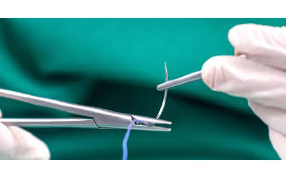 Understanding Surgical Sutures: Materials and Applications